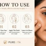Hydrocolloid Pimple Patches